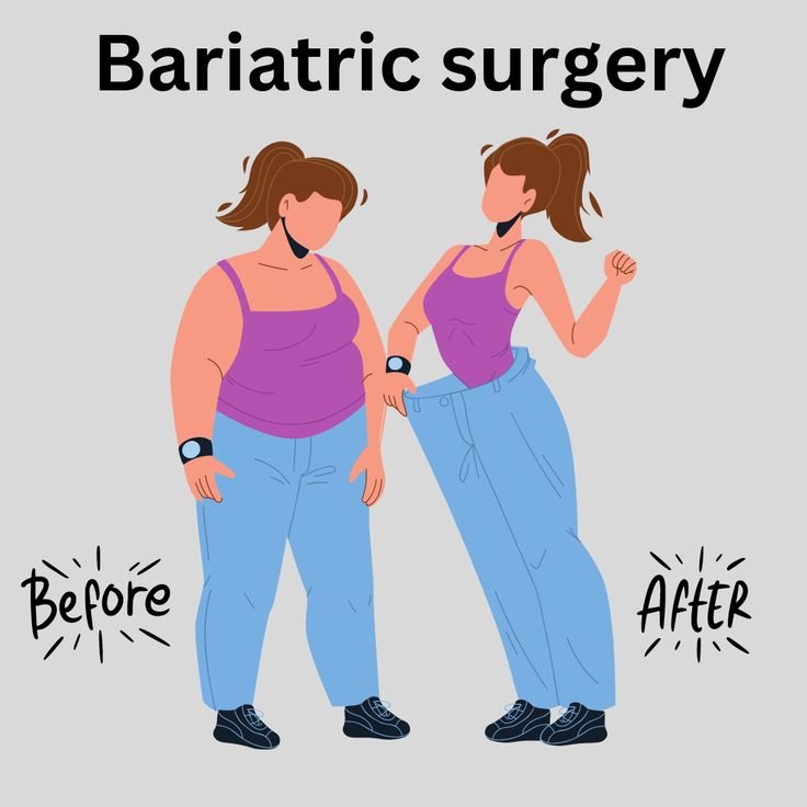 Best Bariatric Surgeon in Mumbai