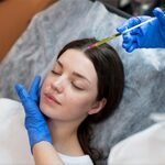 Microneedling treatment in florida