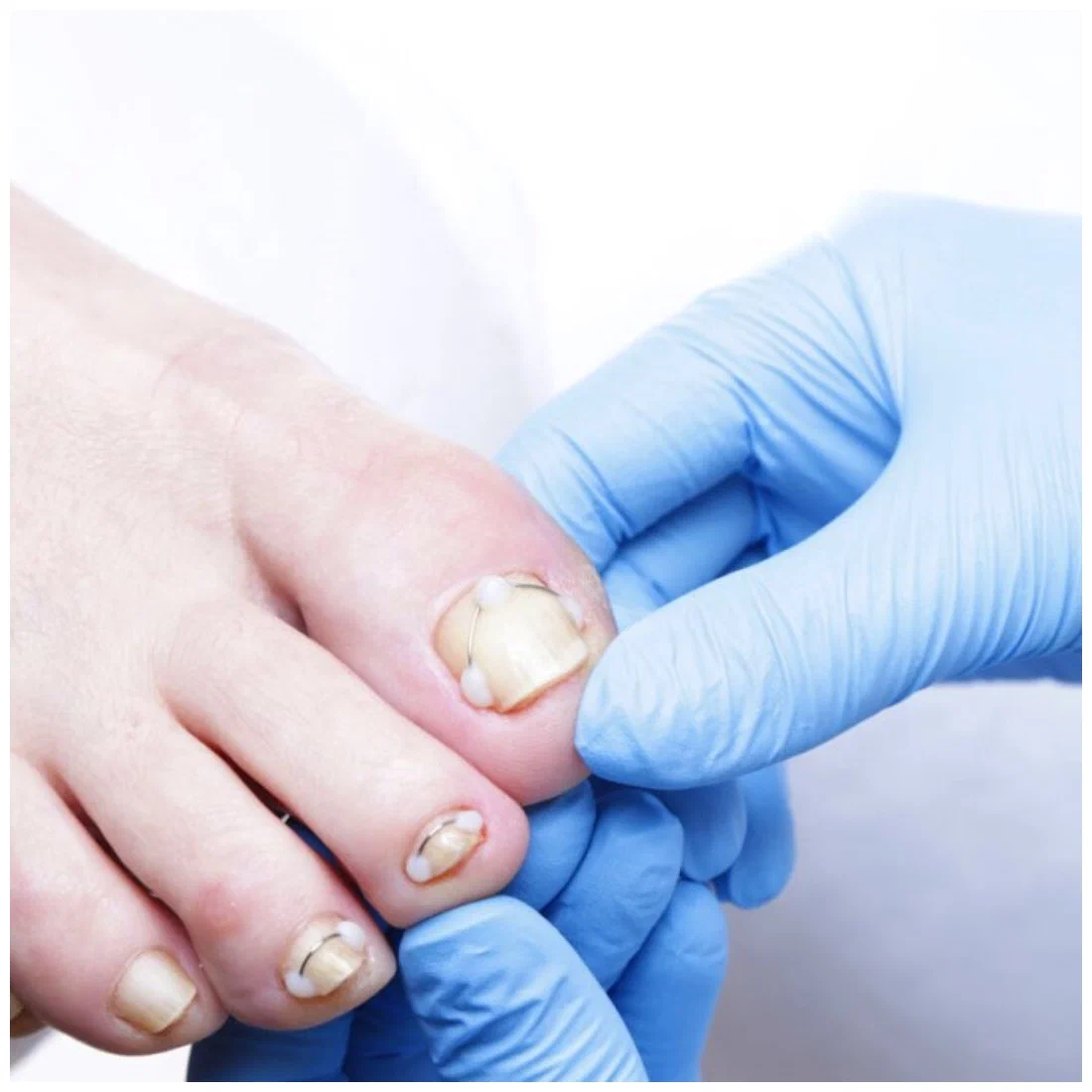 Nail Care and Reconstruction Services in Edinburgh