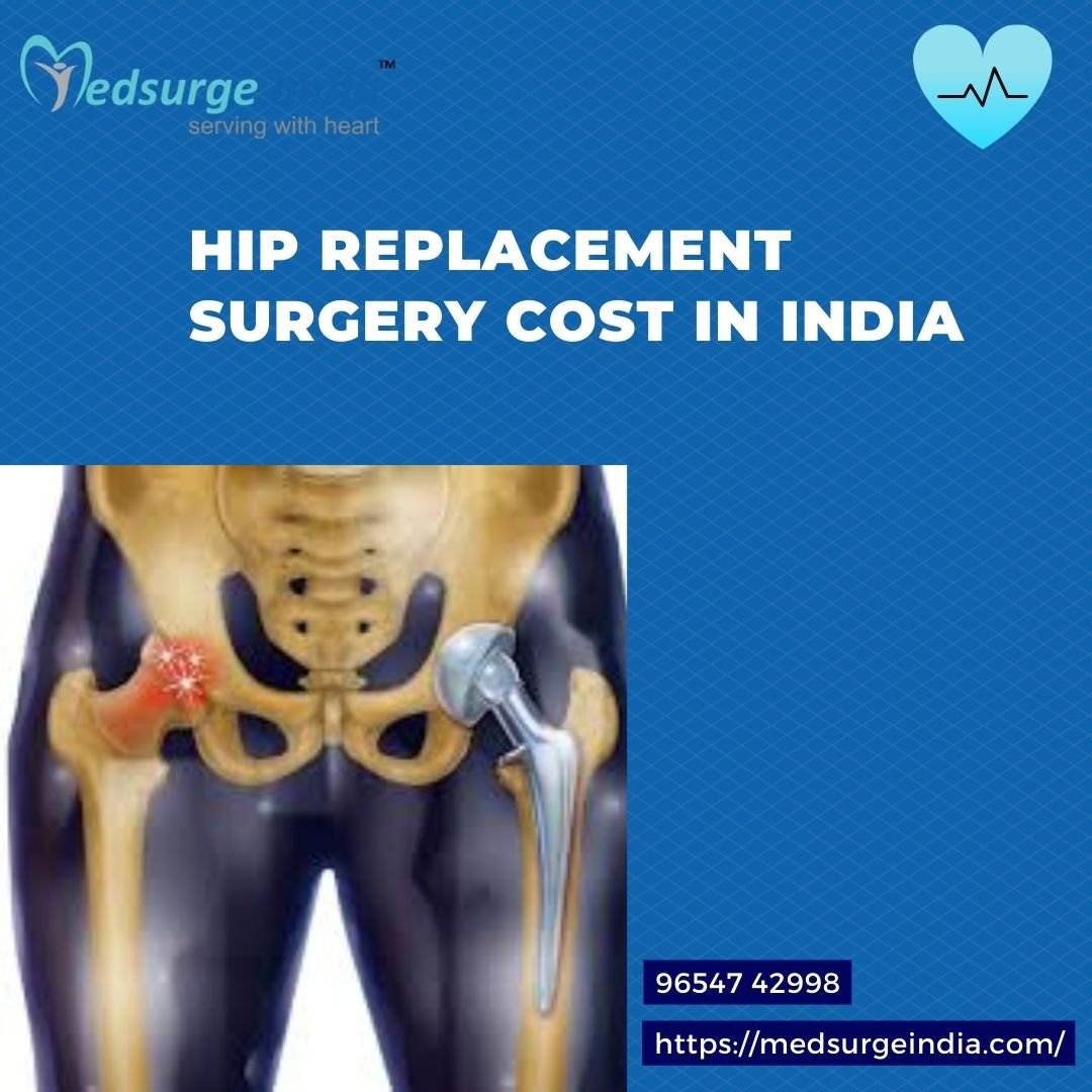 Hip Replacement Surgery Cost in India